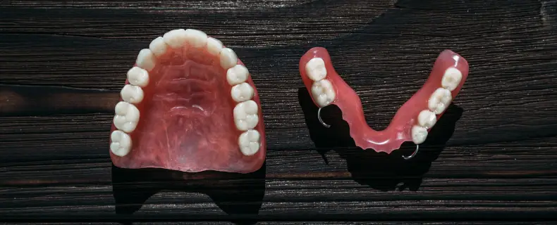 bridge or dentures